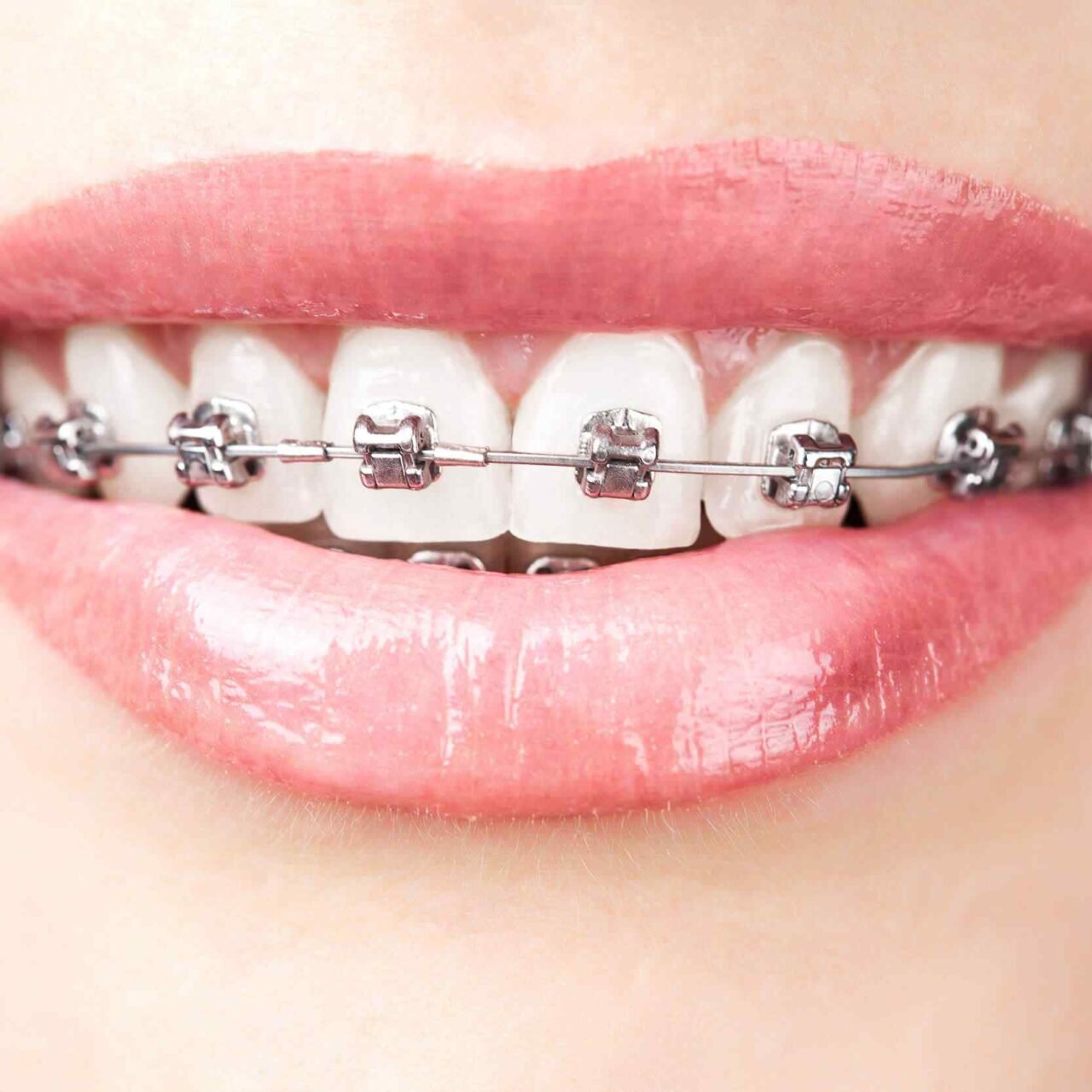 https://dentaldesigndistrict.com/wp-content/uploads/2020/01/post-03-1280x1280.jpg