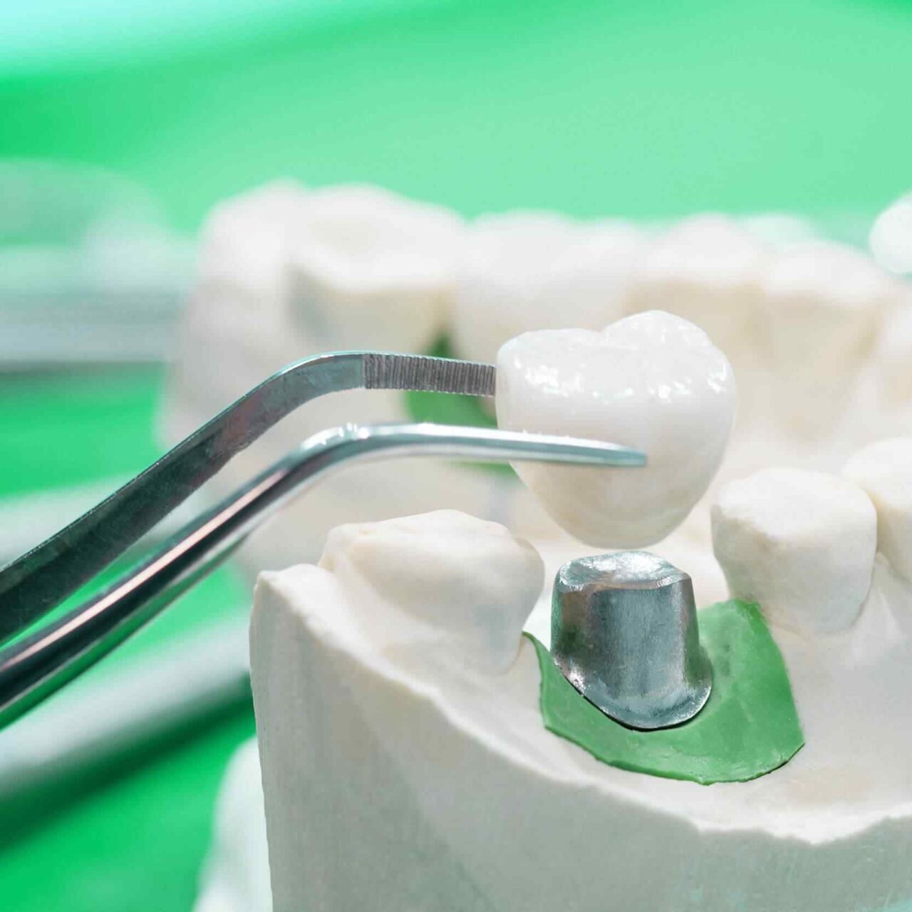 https://dentaldesigndistrict.com/wp-content/uploads/2020/01/post-28-1280x1280.jpg