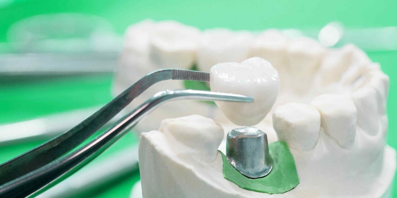 https://dentaldesigndistrict.com/wp-content/uploads/2020/01/post-28-1280x640.jpg